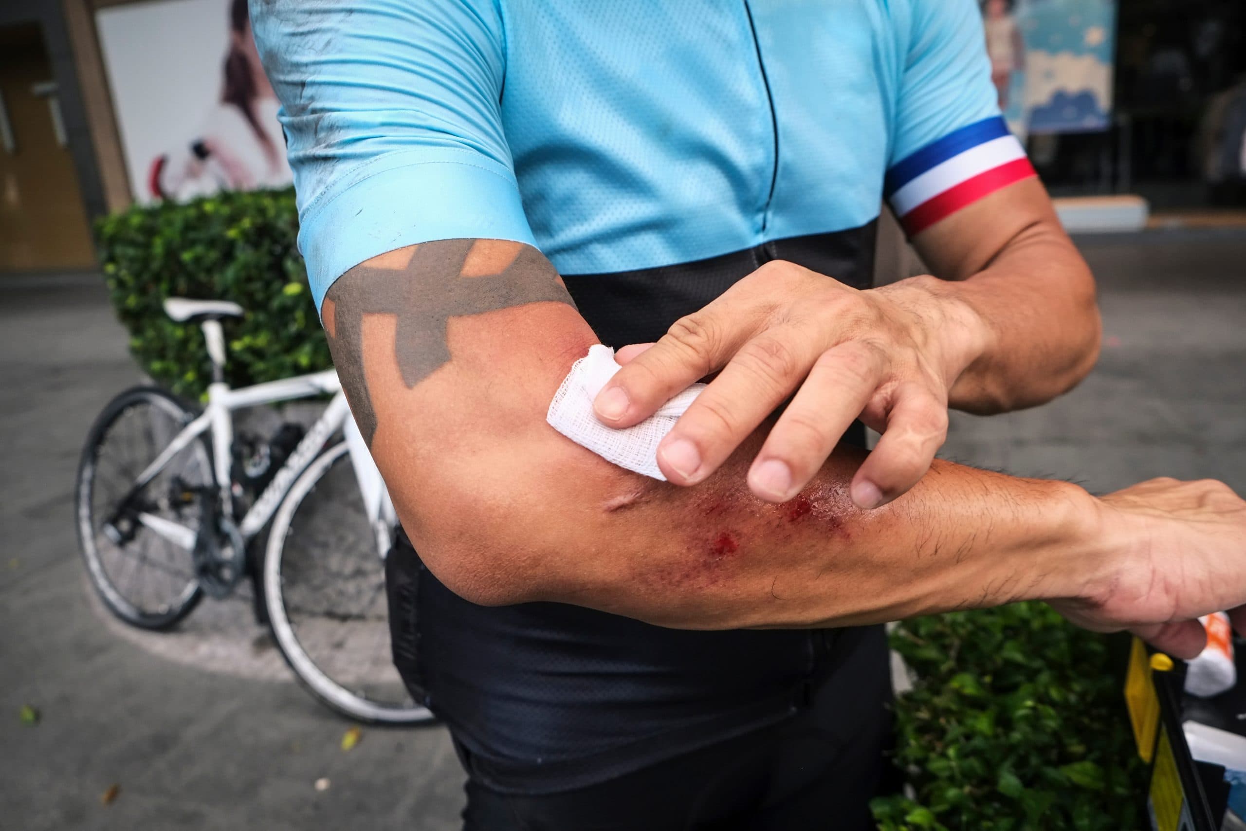 Abrasions / Road Rash