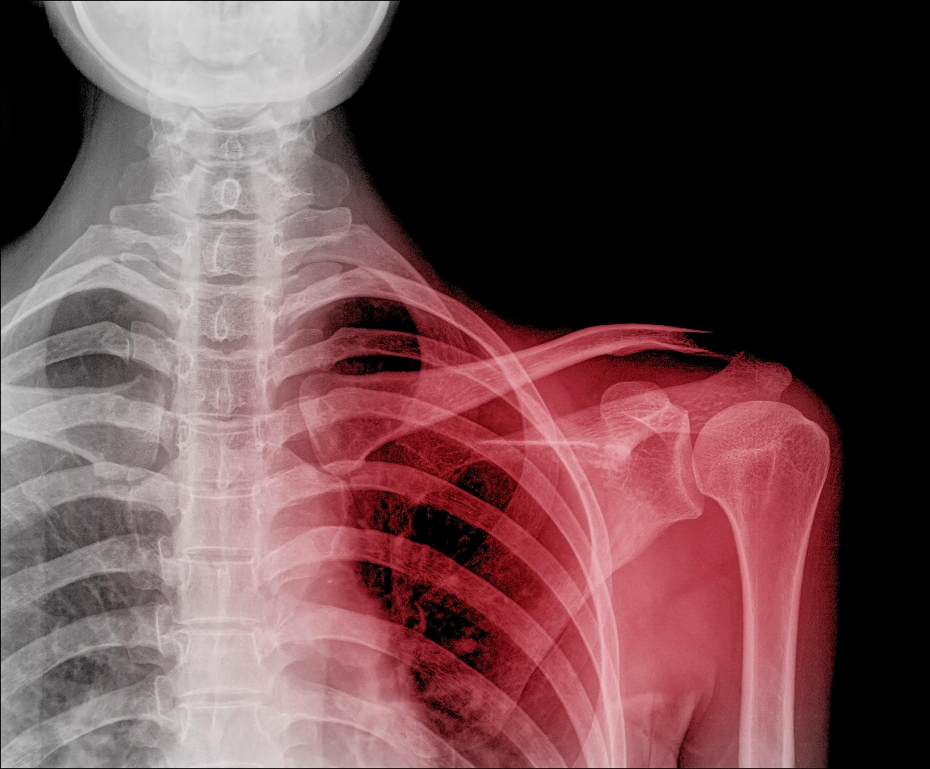 Fractures and Dislocations