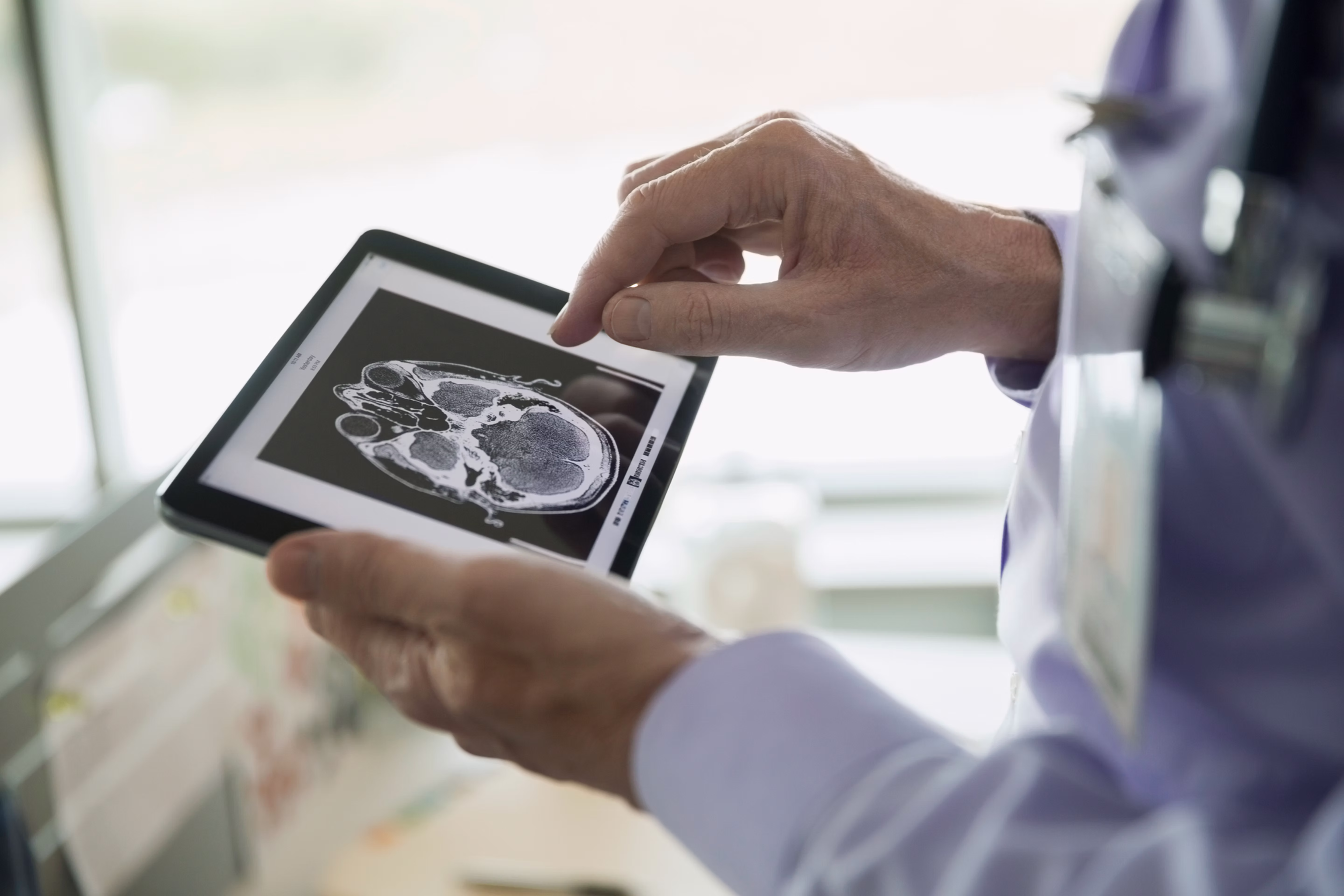 Doctor with MRI and X-ray