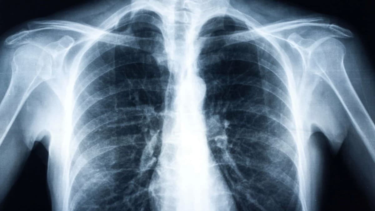 X Ray