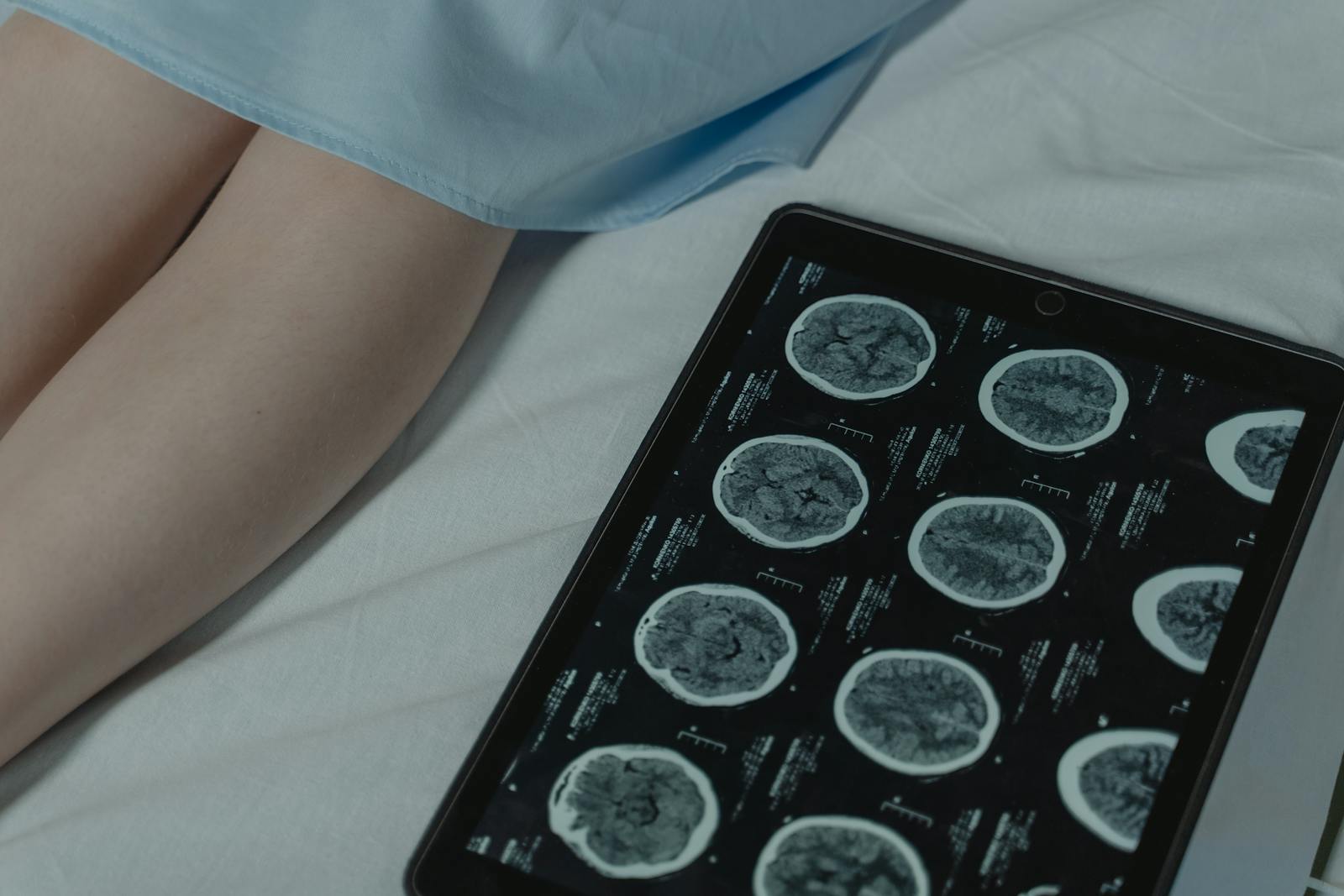 Concussion After a Car Accident: Symptoms and Red Flags