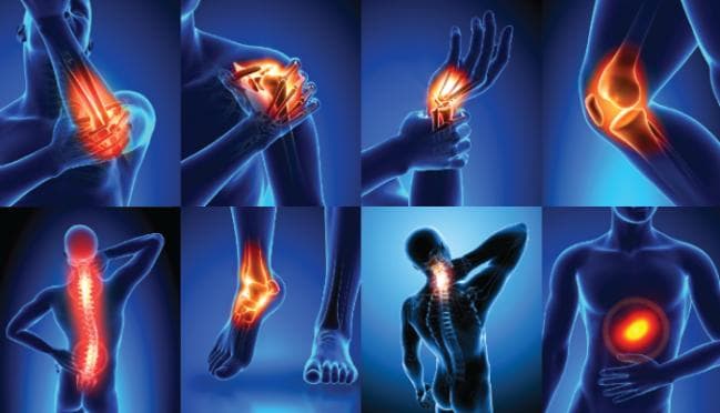 Chronic Pain Issues