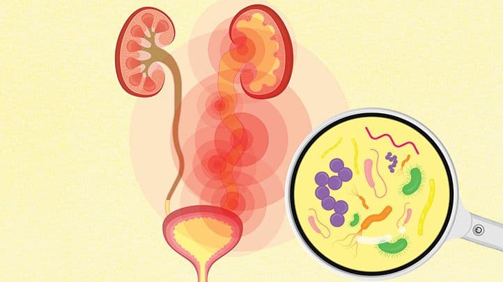 UTIs & Women's Health