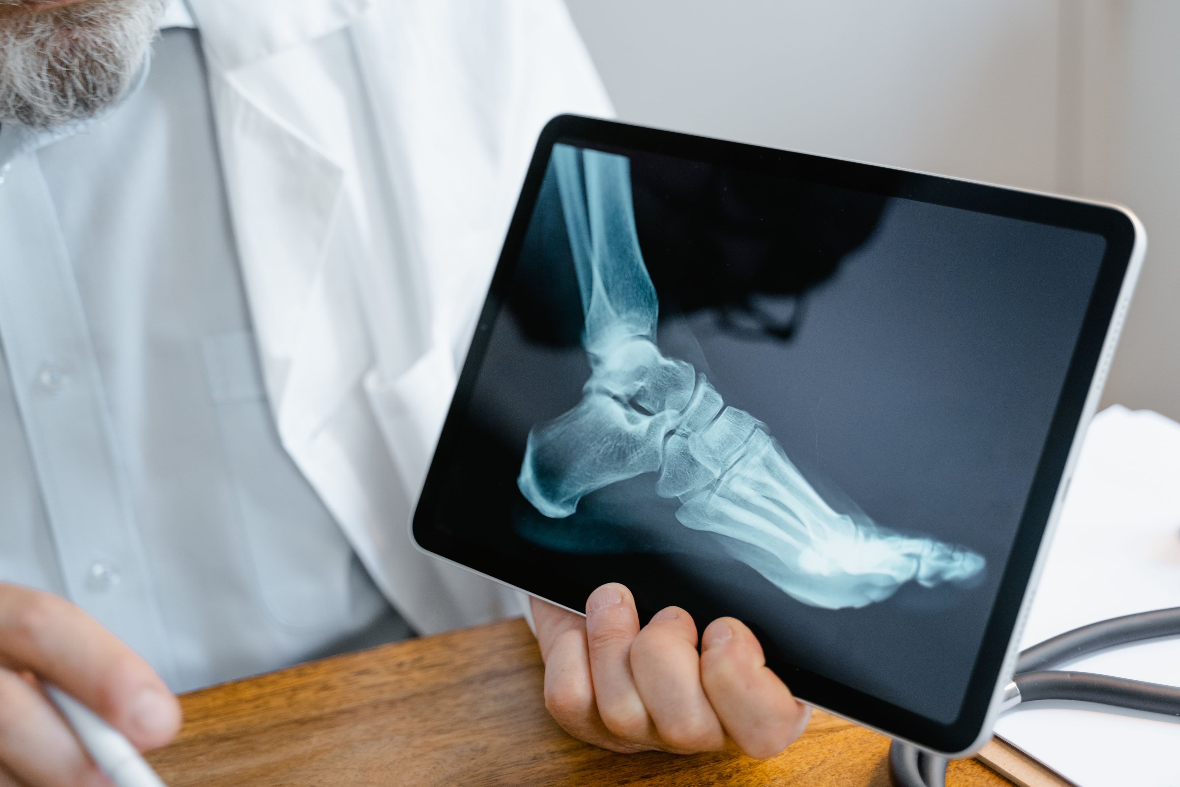 Ankle Pain After a Car Accident: Sprain, Fracture, or Worse?